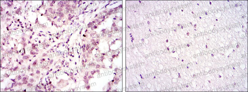 Anti-ATF2 Antibody (R3D97)