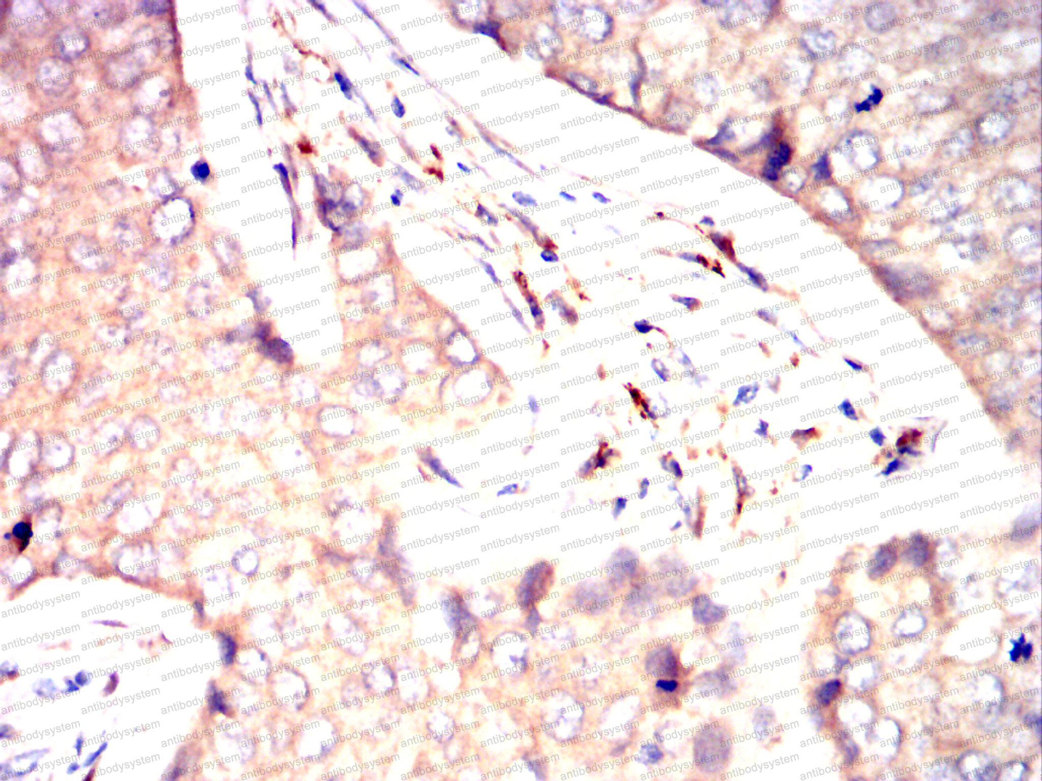 Anti-CD116/CSF2RA Antibody (R3E04)