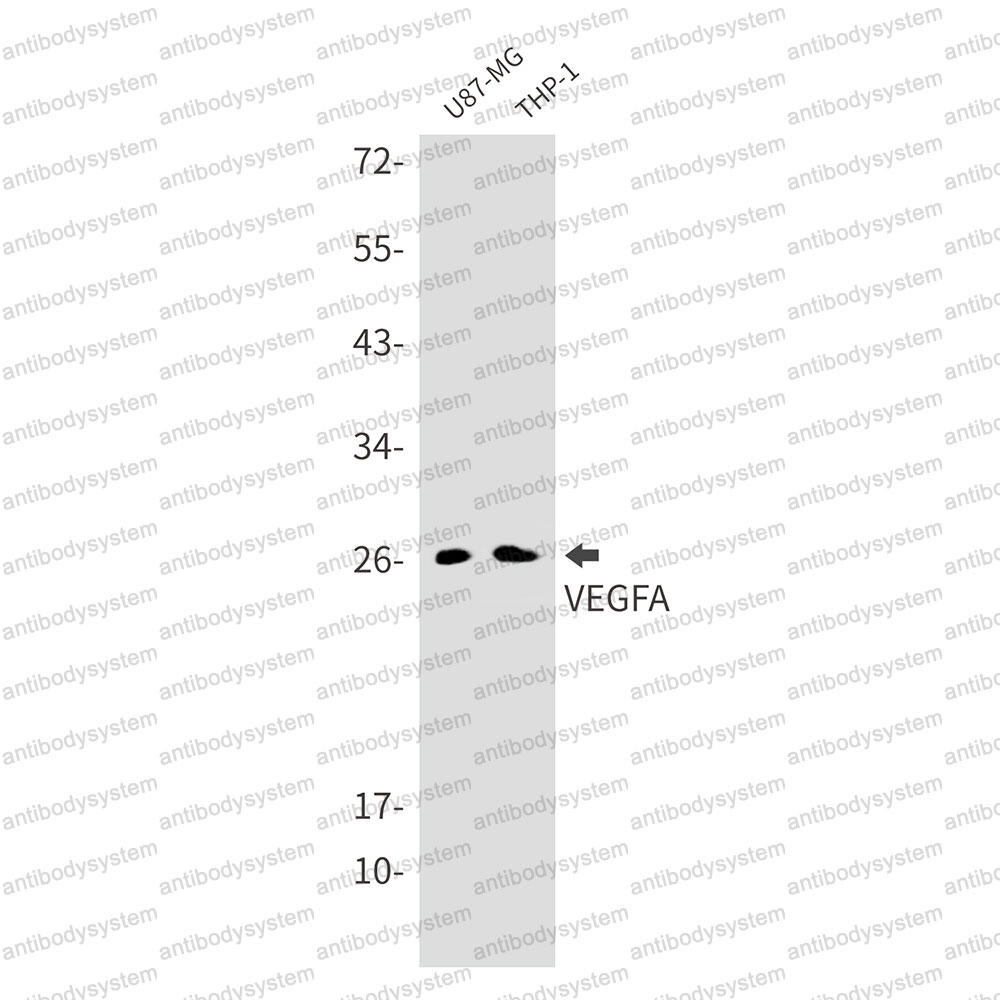Anti-VEGFA Antibody (R1P83)