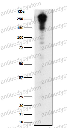 Anti-DSP Antibody (R1P84)