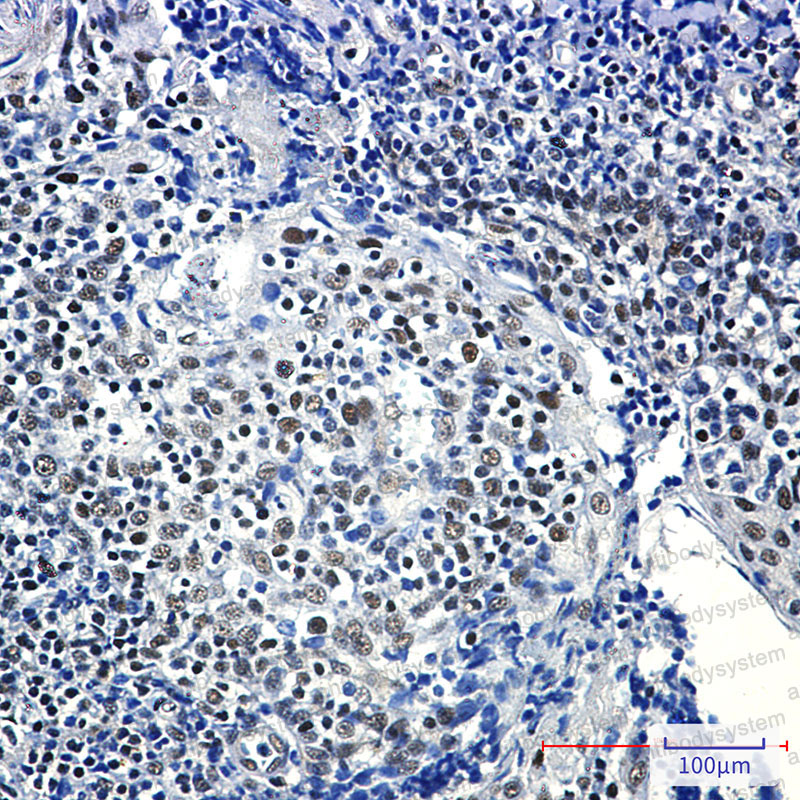 Anti-RPA2 Antibody (R1P85)