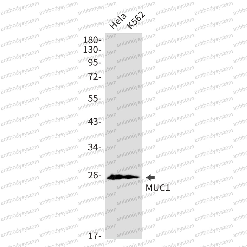 Anti-CD227/MUC1 Antibody (R1P86)