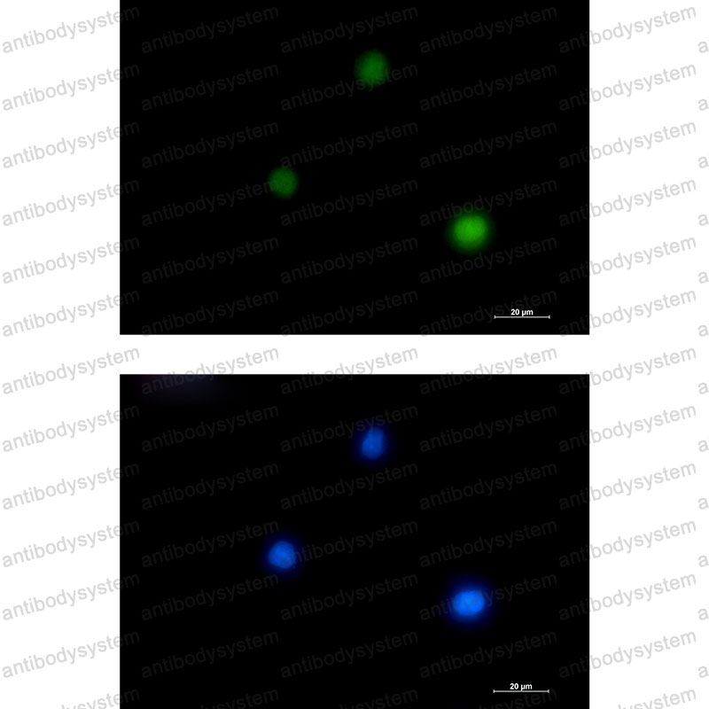 Anti-GATA1 Antibody (R1P87)