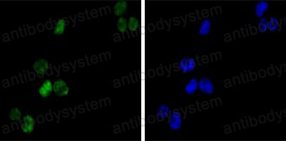 Anti-GATA1 Antibody (R3E21)