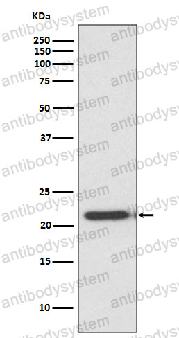 Anti-TIMP2 Antibody (R1P88)