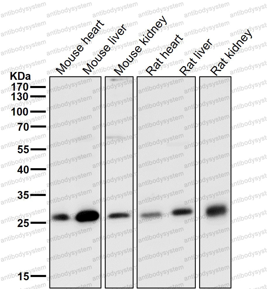 Anti-NQO2 Antibody (R1P90)