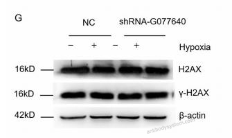 Western Blot for Anti-Phospho-γ-H2AX (pS139) Antibody (C6) ?>