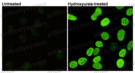 Anti-Phospho-Histone H2A.X (Ser139) Antibody (R3E27)
