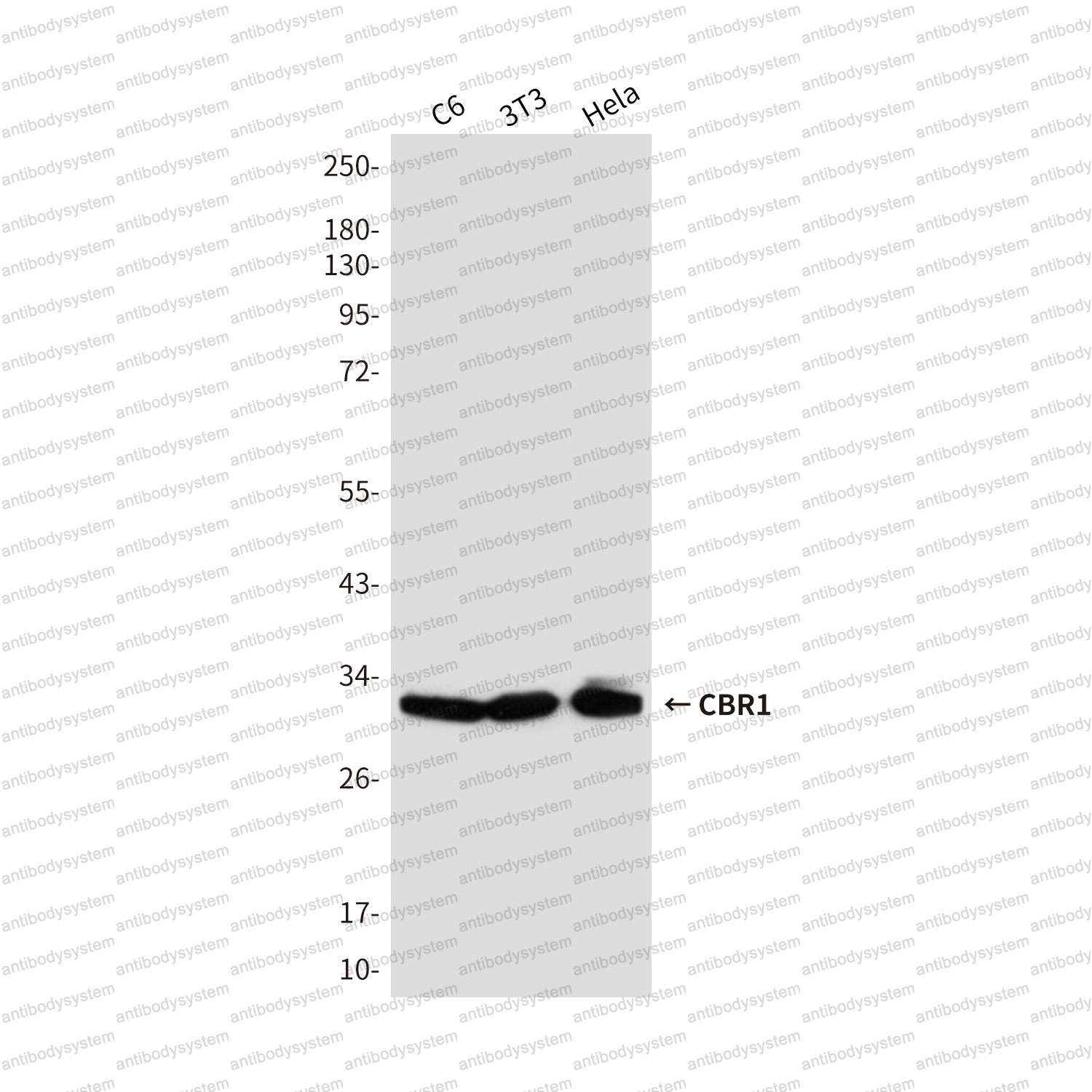Anti-CBR1 Antibody (R3E35)