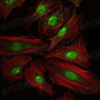 Anti-CREB1 Antibody (R3E36)