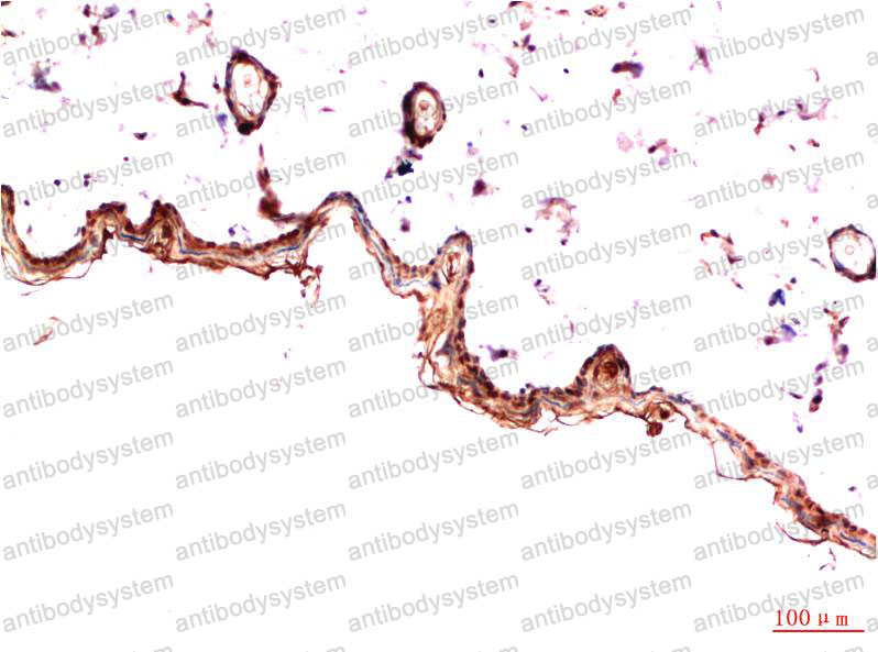 Anti-CD140a/PDGFRA Antibody (R3E42)