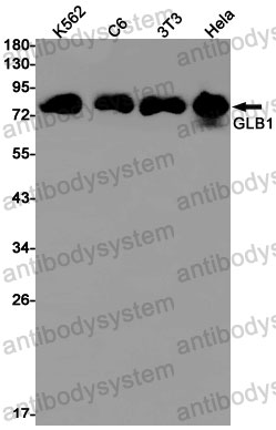 Anti-GLB1 Antibody (R1Q05)