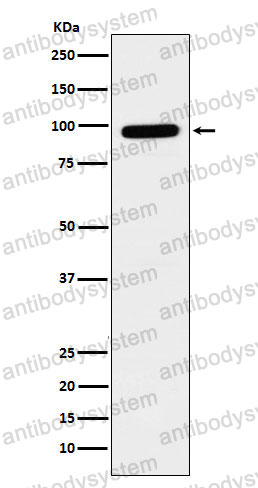 Anti-GLB1 Antibody (R1Q04)