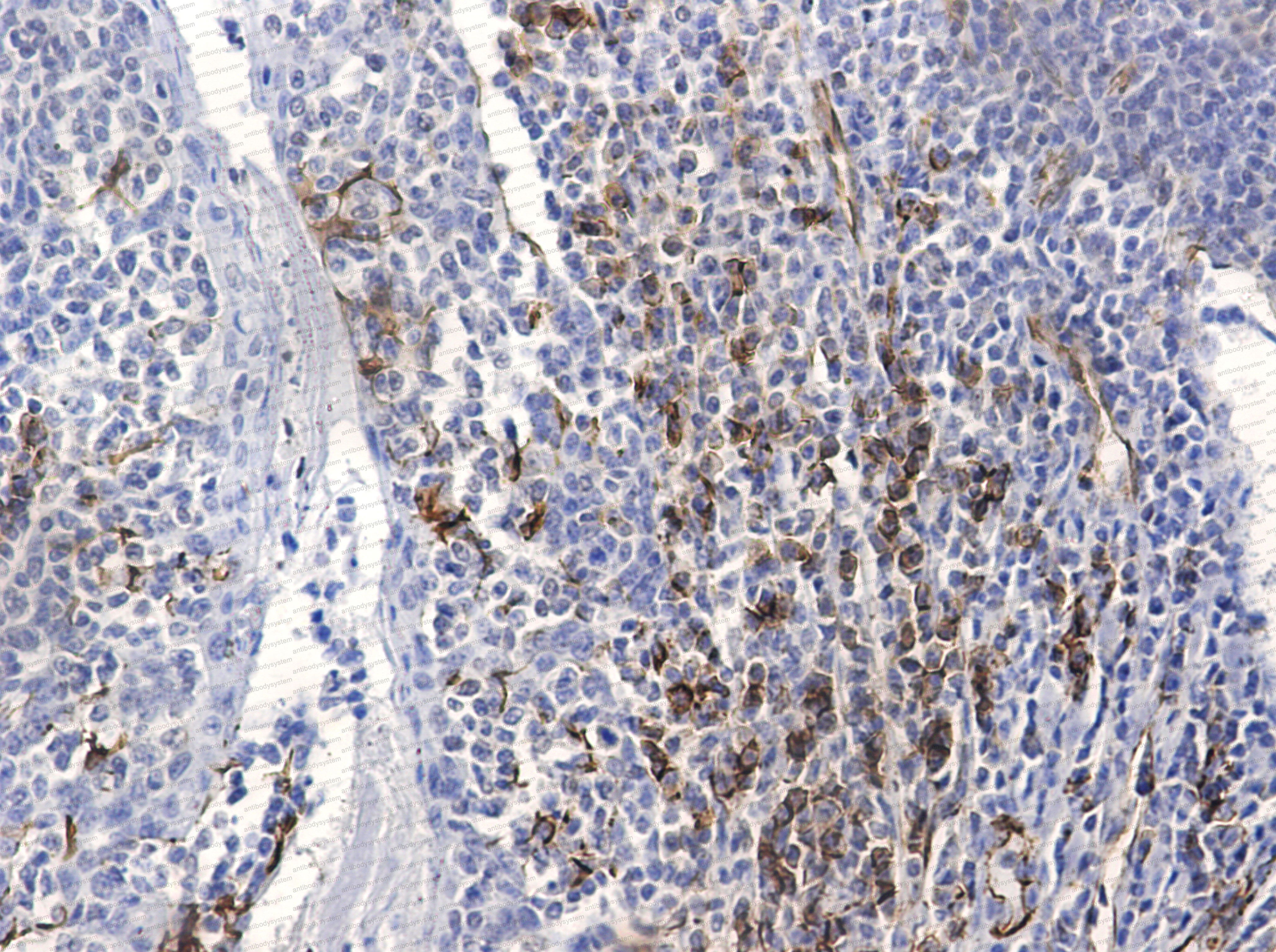 Anti-CD31/PECAM1 Antibody (R3E44)