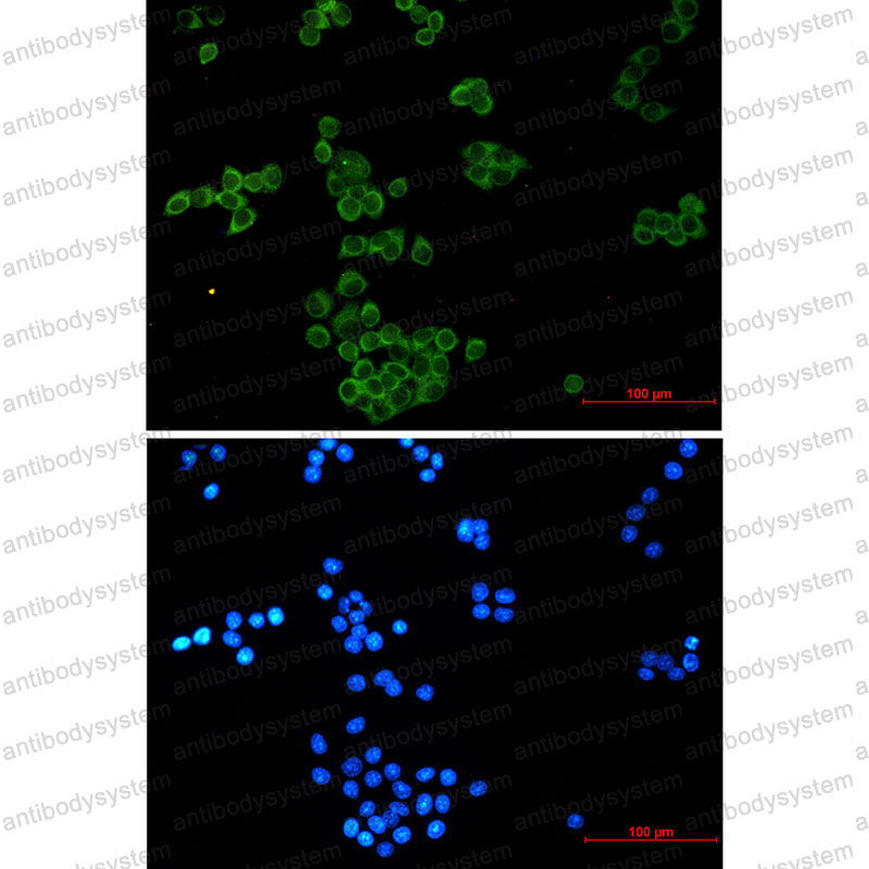 Anti-NCK1 Antibody (R1Q07)