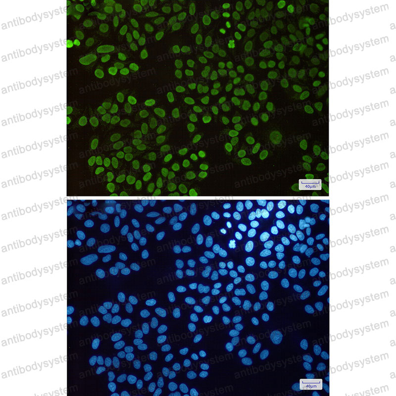 Anti-Histone H1.3 Antibody (R1Q08)