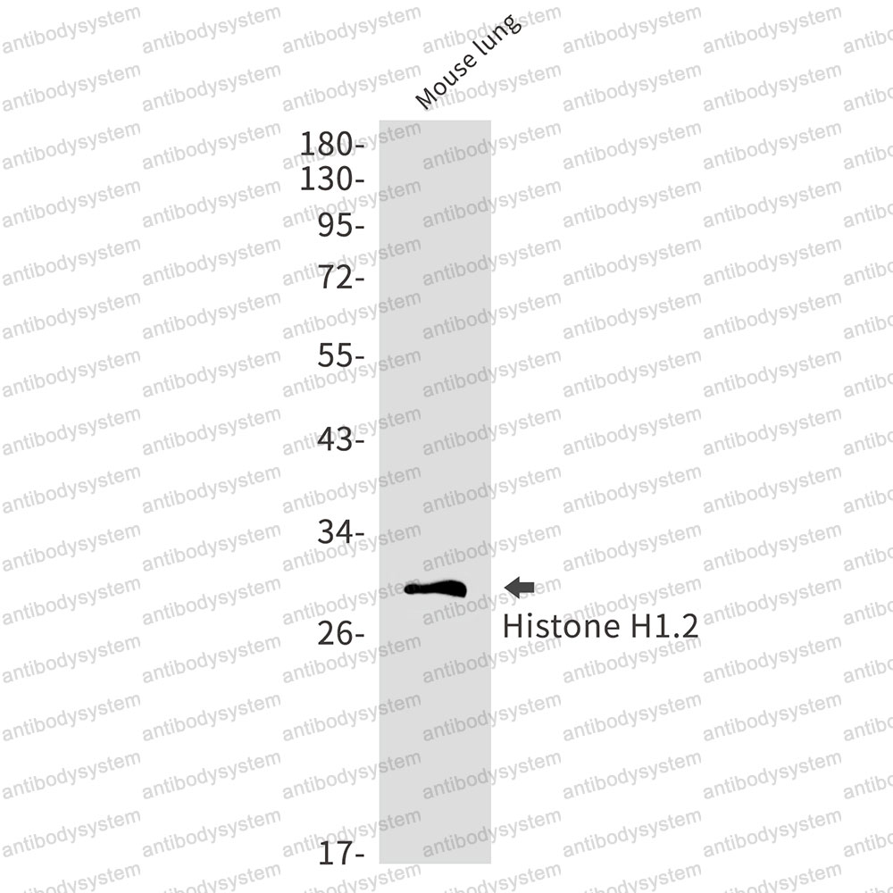 Anti-Histone H1.2 Antibody (R1Q10)