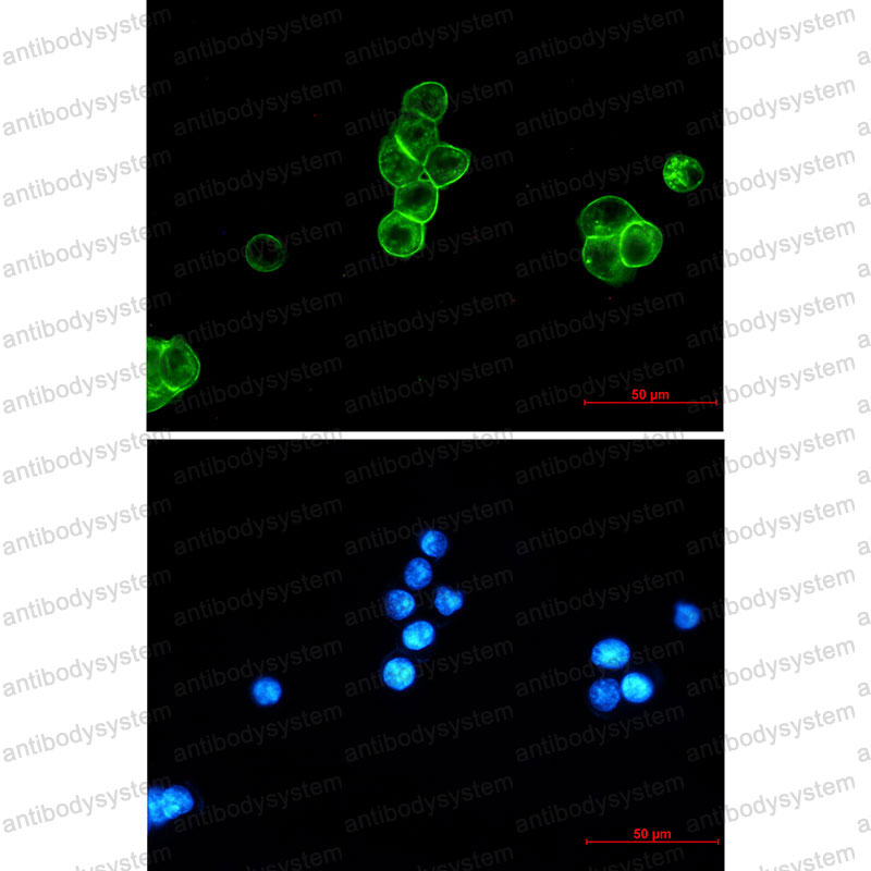 Anti-CD326/EPCAM Antibody (R1Q12)