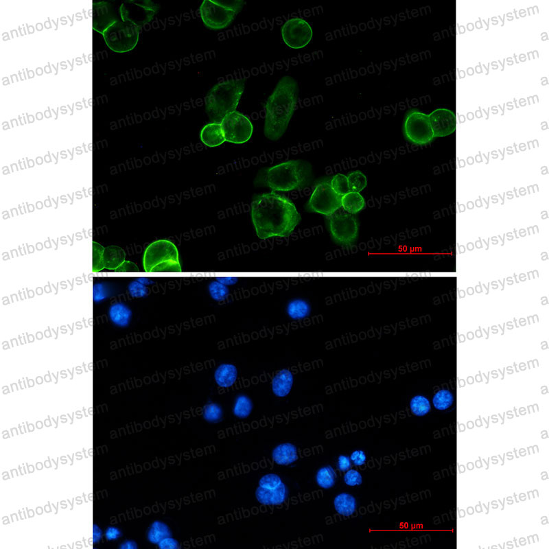 Anti-CD326/EPCAM Antibody (R1Q11)