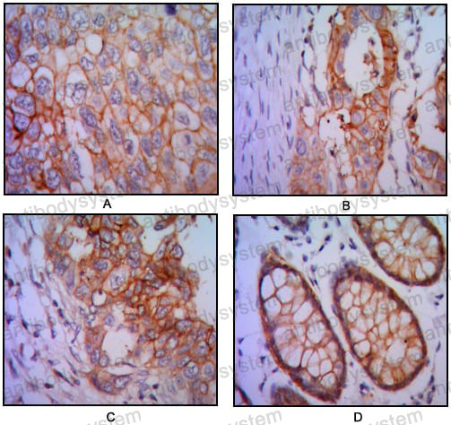 Anti-CD326/EPCAM Antibody (R3E47)