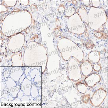 Anti-TSHR/LGR3 Antibody (R3E54)