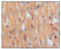 Anti-BNP Antibody (R3E60)