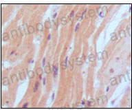 Anti-BNP Antibody (R3E61)