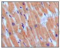 Anti-BNP Antibody (R3E62)