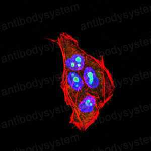 Anti-PLCG2 Antibody (R3E65)