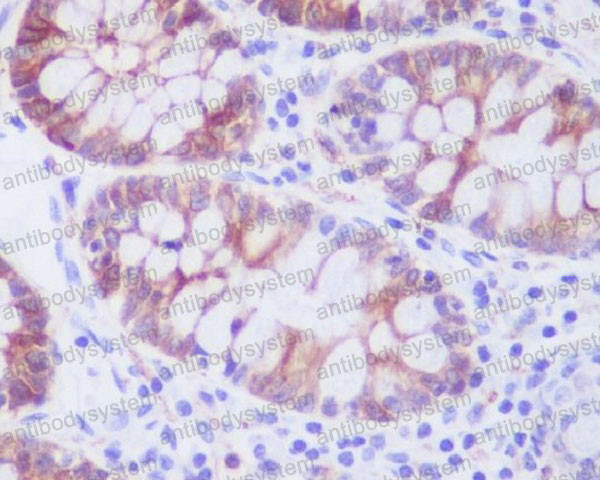 Anti-STMN1 Antibody (R1B95)