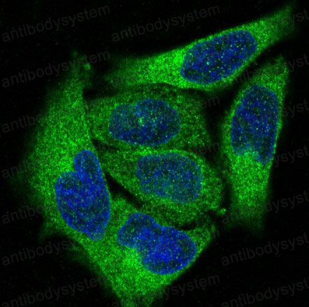 Anti-PRKCA Antibody (R1B40)