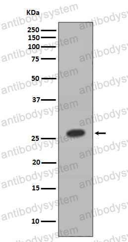 Anti-HOXB9 Antibody (R1B97)
