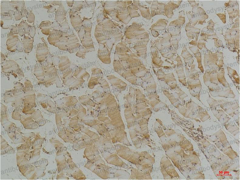 Anti-DES/Desmin Antibody (R3E73)