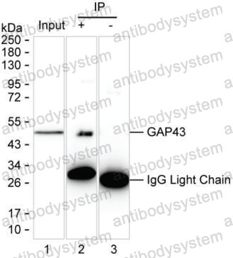 Anti-GAP43 Antibody (R3E76)