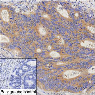 Anti-TPH1 Antibody (R3E78)
