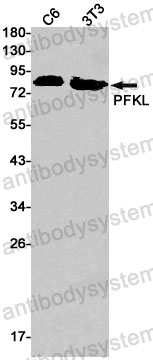 Western blot for Anti-PFKL Antibody (R1Q57) ?>