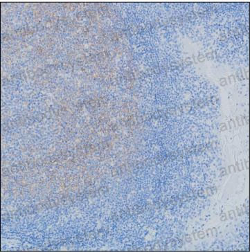 Anti-CD35/CR1 Antibody (R3E85)