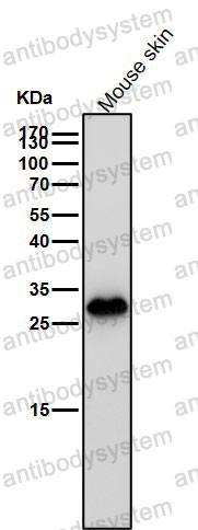 Anti-LGALS3/Galectin-3 Antibody (R1A61)