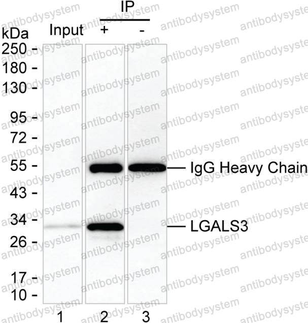 Anti-LGALS3/Galectin-3 Antibody (R3E86)