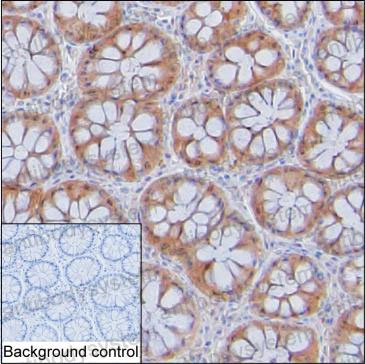 Anti-LGALS3/Galectin-3 Antibody (R3E87)