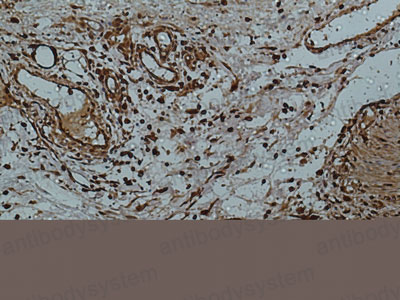 Anti-LGALS3/Galectin-3 Antibody (R3E88)