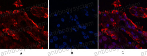 Anti-LGALS3/Galectin-3 Antibody (R3E89)