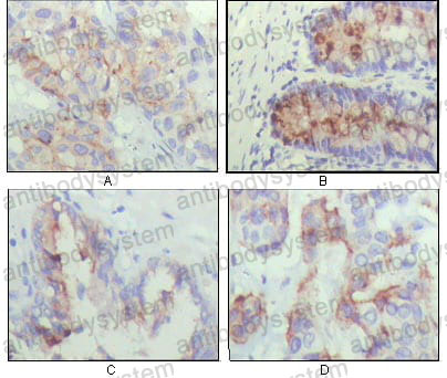 Anti-IGFBP2 Antibody (R3E96)