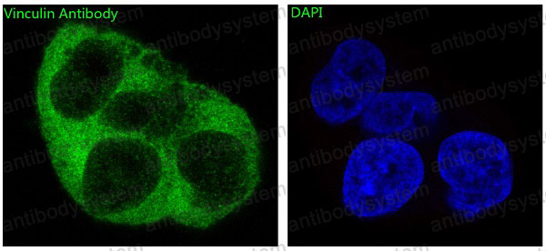 Anti-VCL/Vinculin Antibody (R1A75)