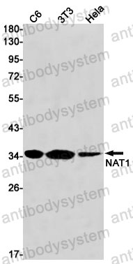 Anti-NAT1 Antibody (R1Q85)