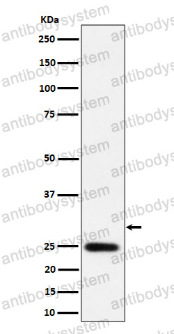 Anti-NAT1 Antibody (R1Q84)
