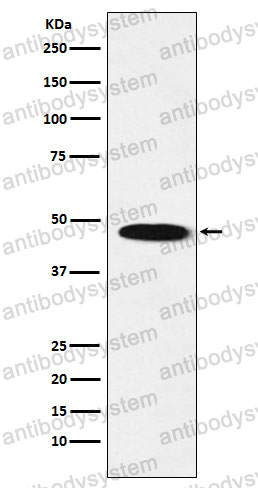 Anti-GABRB1 Antibody (R1Q86)