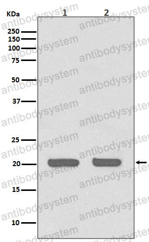 Anti-IL1RN/IL-1ra/IL1F3 Antibody (R1Q87)