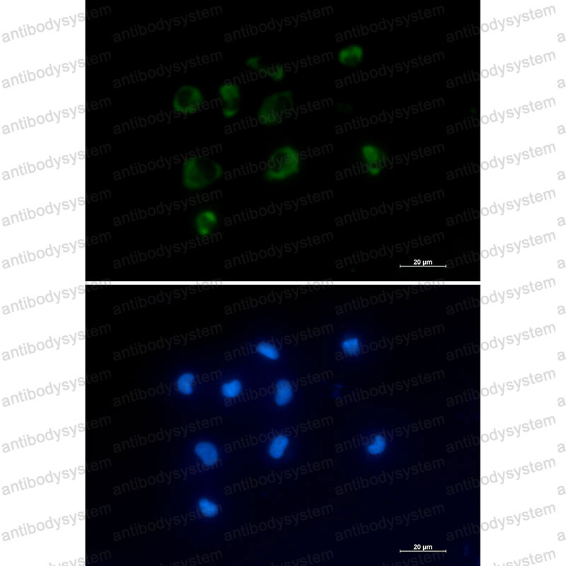 Anti-IL1RN/IL-1ra/IL1F3 Antibody (R1Q88)