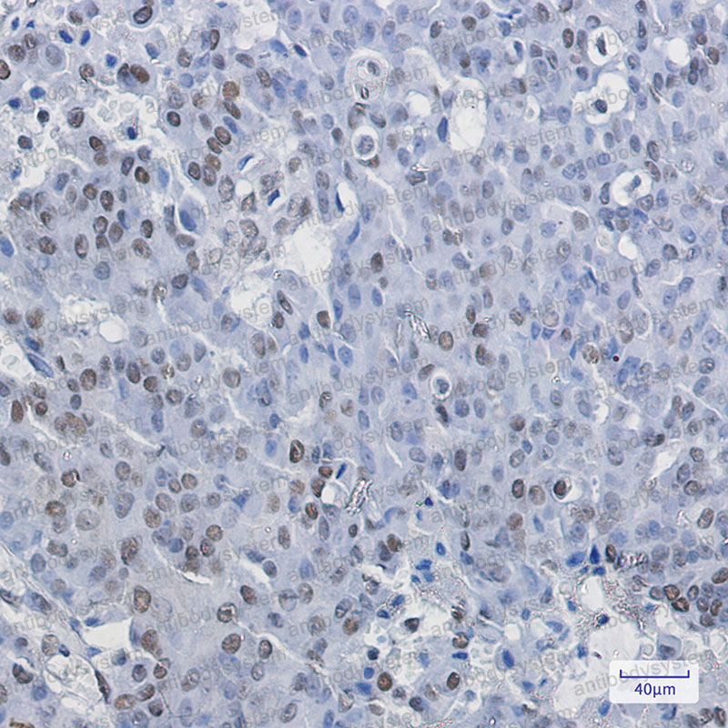 Anti-NELFE Antibody (R1Q90)